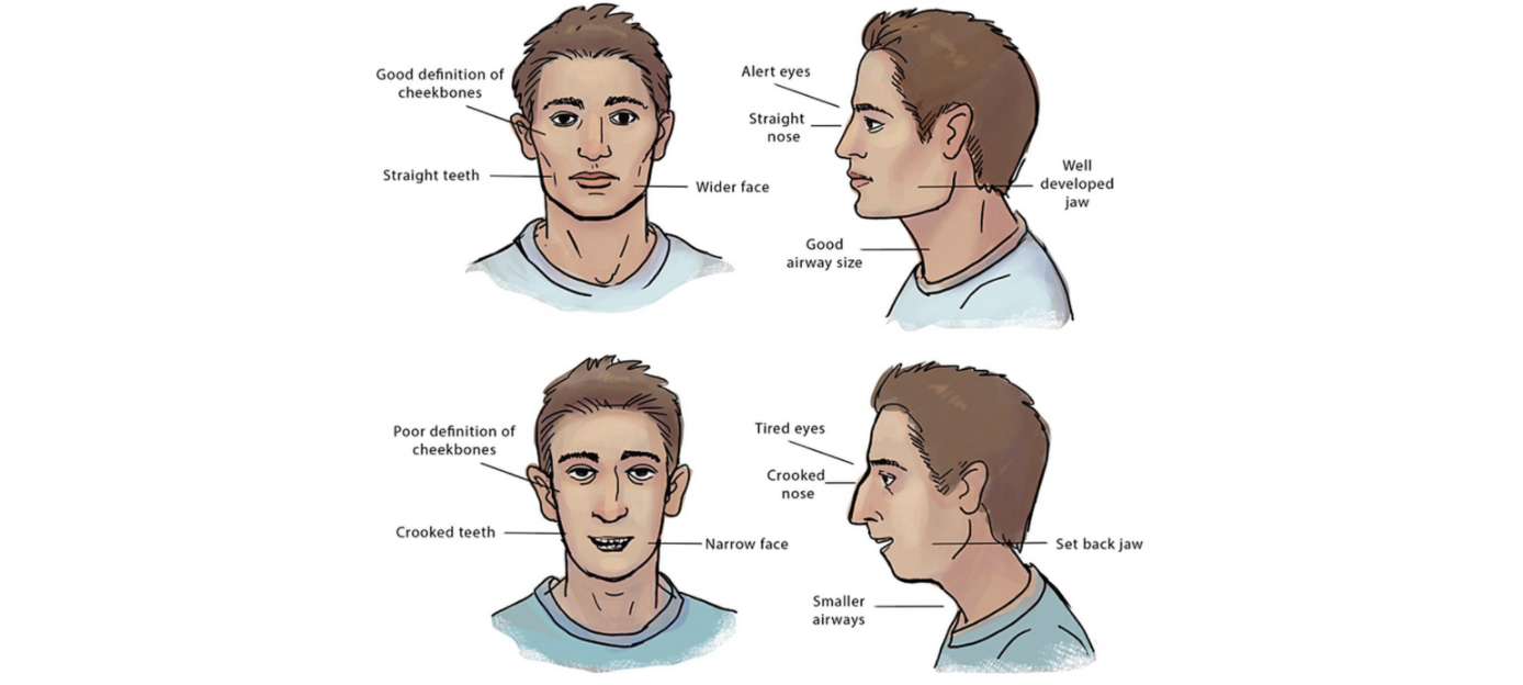 Nasal Breathing